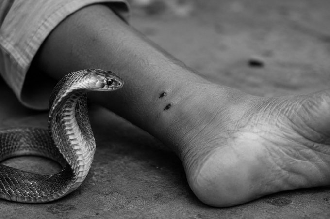 Snake Bites 6 Girls at Gadchiroli Tribal School Hostel, 3 Dead, Probe Ordered