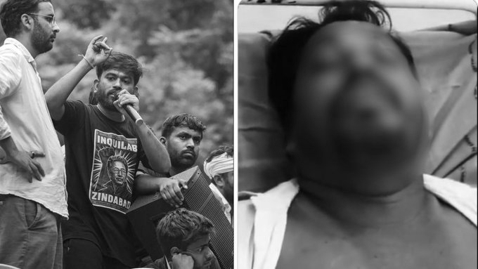 CJP Volunteer’s Father Dies After Alleged Attack Over School Audit in Bengal, 3 Arrested