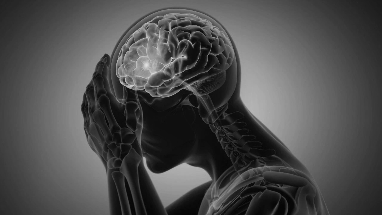 Stroke Can Strike in Your 20s and 30s: Experts Warn of Rising Cases in India